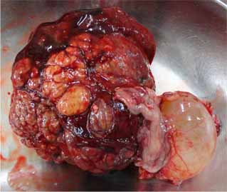犬の肝細胞癌7