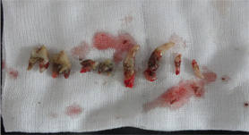 犬の歯槽膿漏4